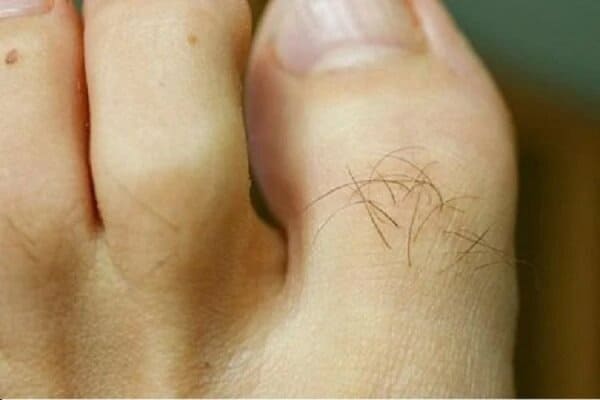 Xem tướng lông trên cơ thể: Lông mọc trên ngón chân